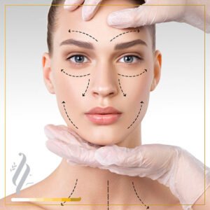 La Armonizacion facial,es el realce de la belleza,por procedimientos esteticos.
